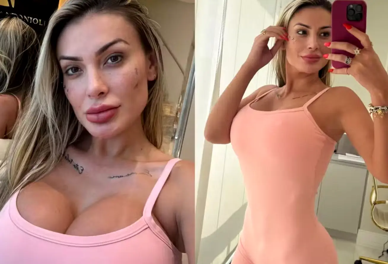 Andressa Urach xuất hiện trong một buổi phỏng vấn công khai. 